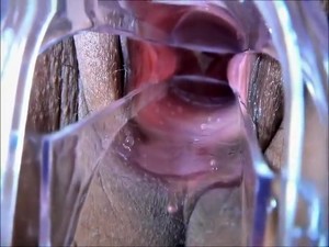 Speculum Vaginal Examination Super Closeup High ...